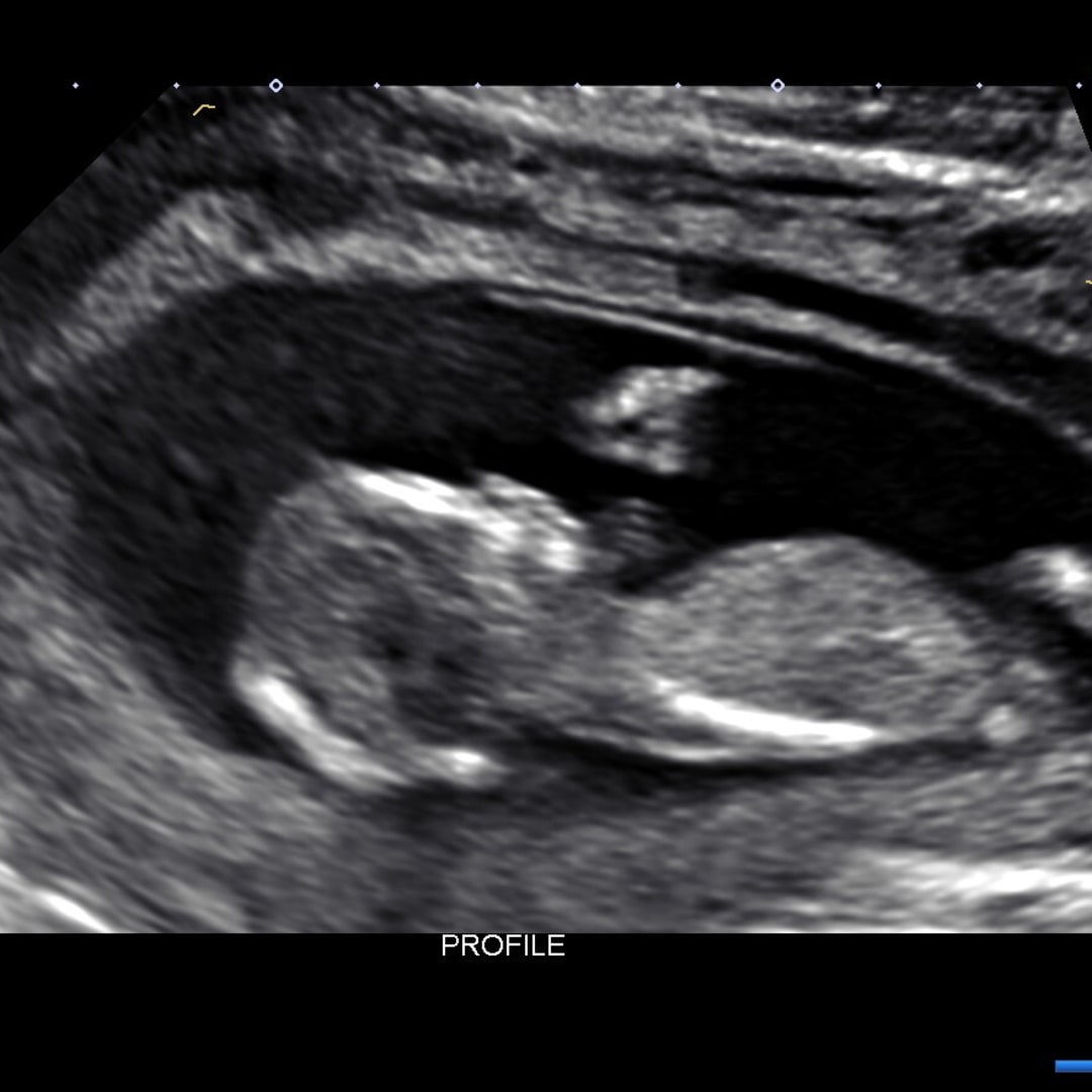Photo shared by Rebecca for their Babylist baby registry.
