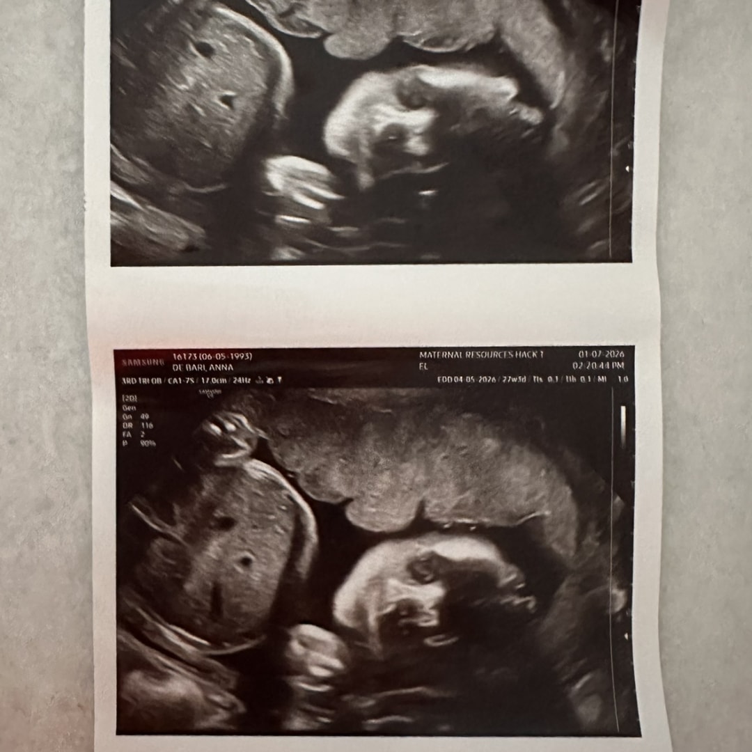 Photo shared by Annamaria for their Babylist baby registry.