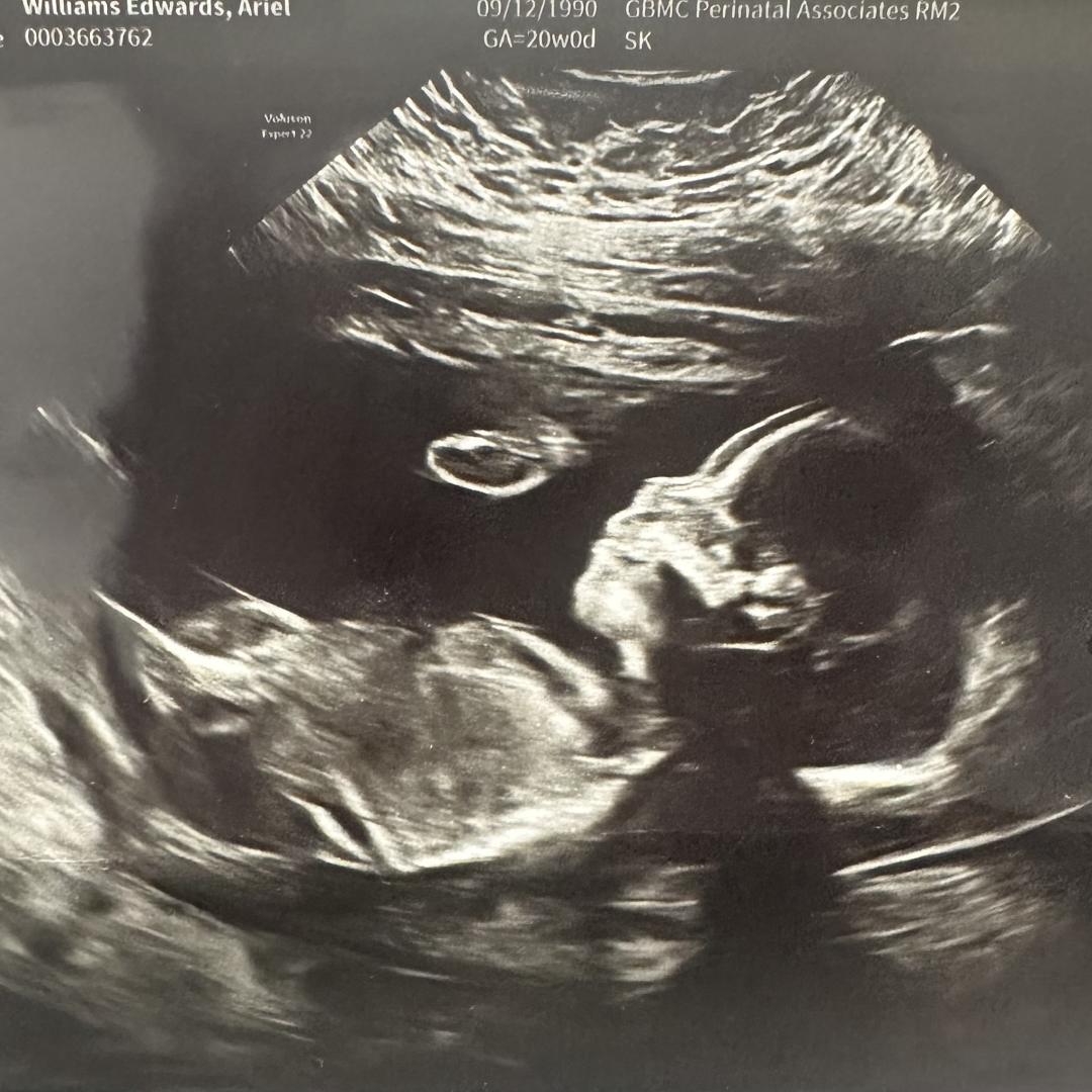 Photo shared by Ariel for their Babylist baby registry.