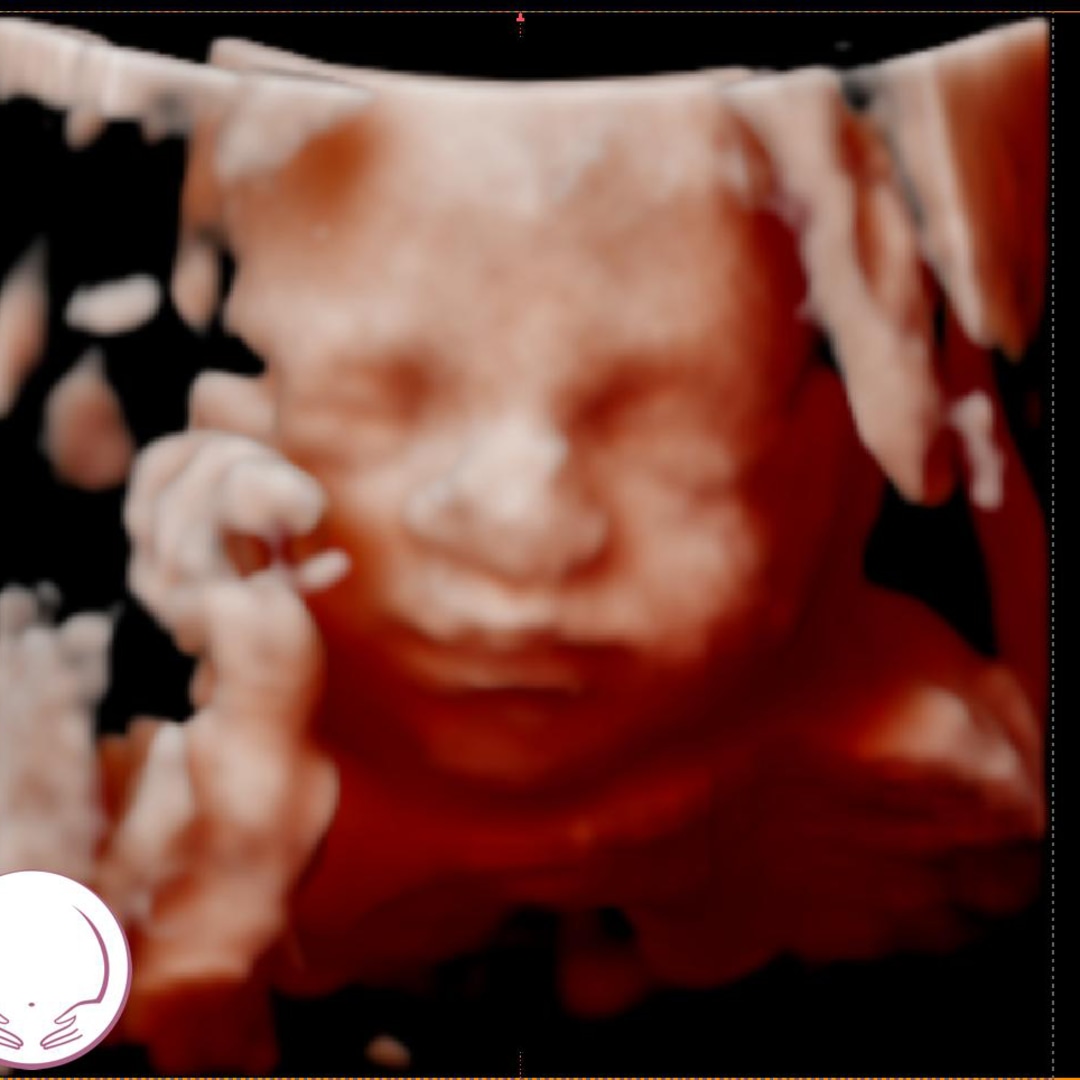 Photo shared by Lesley for their Babylist baby registry.