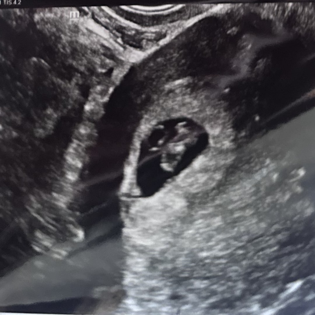 Photo shared by Delayna for their Babylist baby registry.