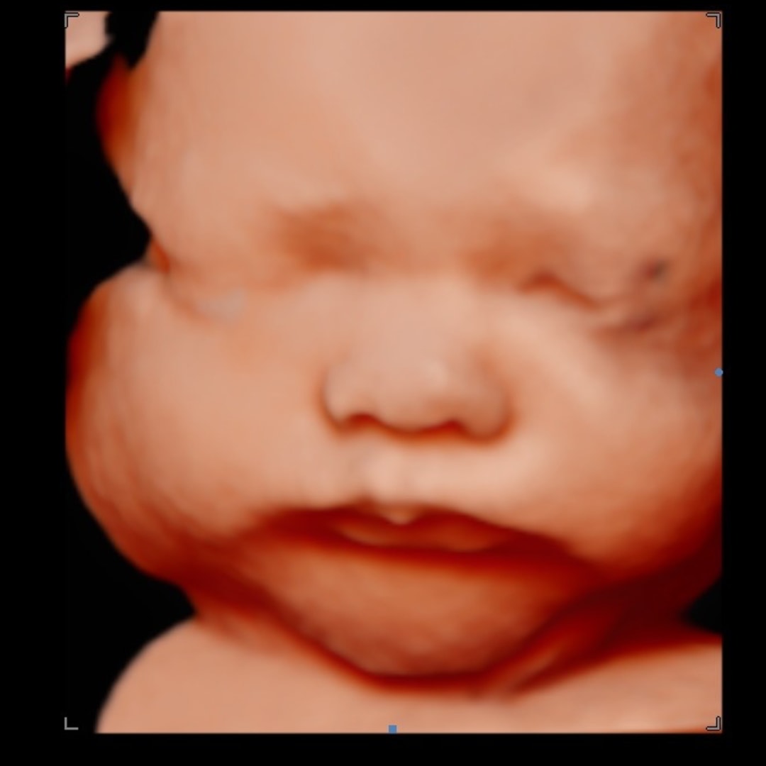 Photo shared by Adrienna for their Babylist baby registry.