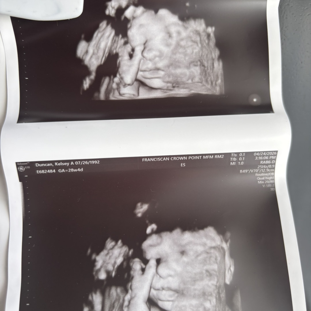Photo shared by Kelsey for their Babylist baby registry.