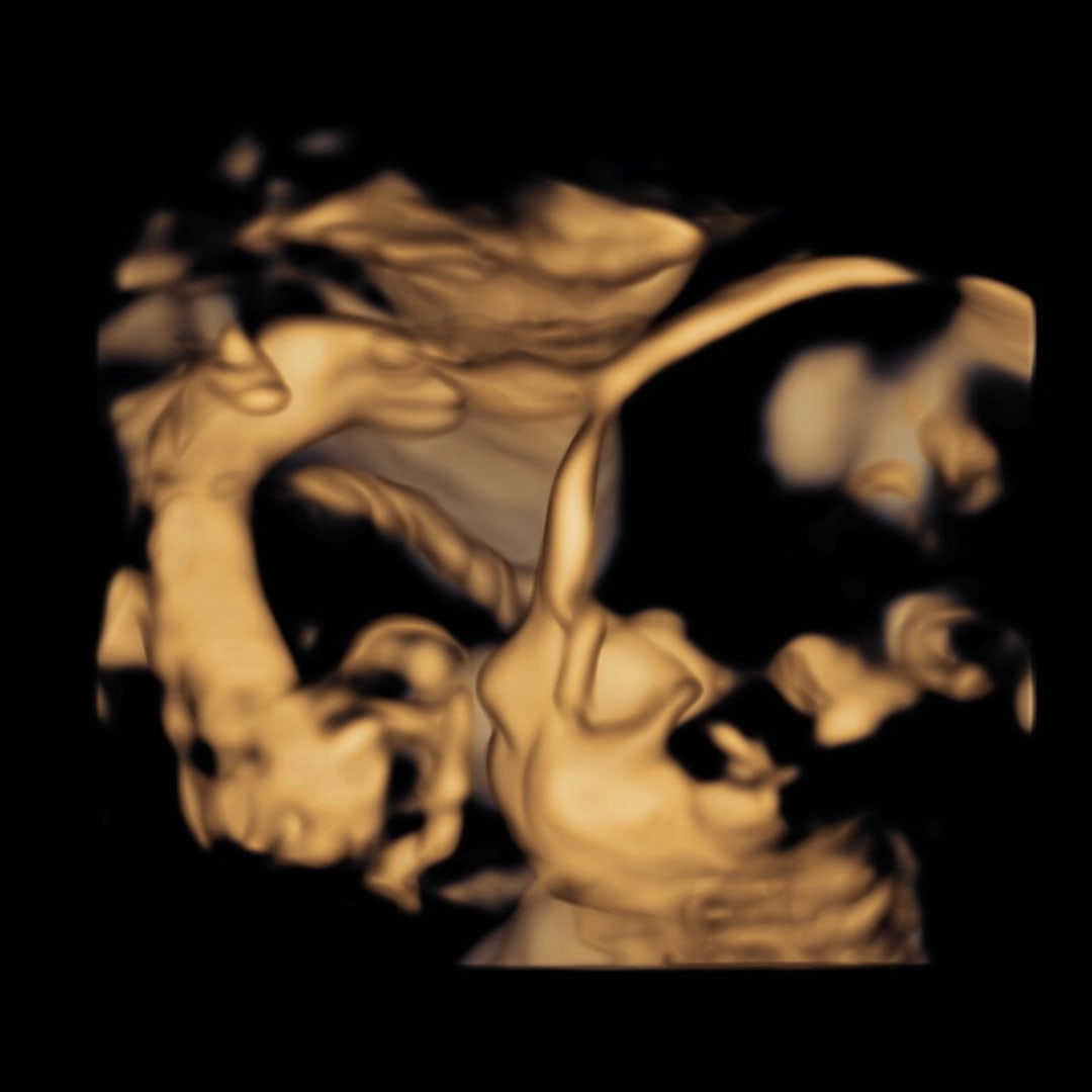 Photo shared by Emma for their Babylist baby registry.