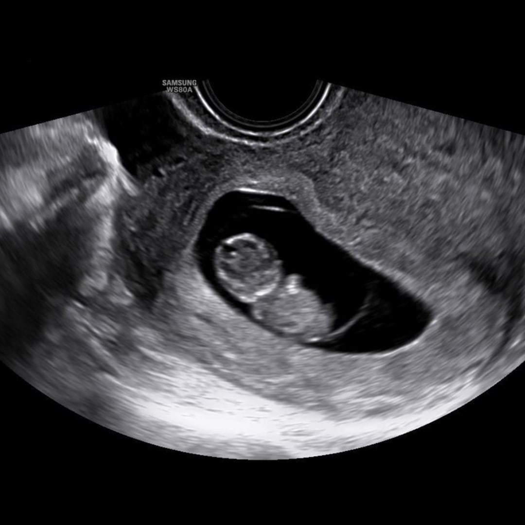 Photo shared by Laci for their Babylist baby registry.