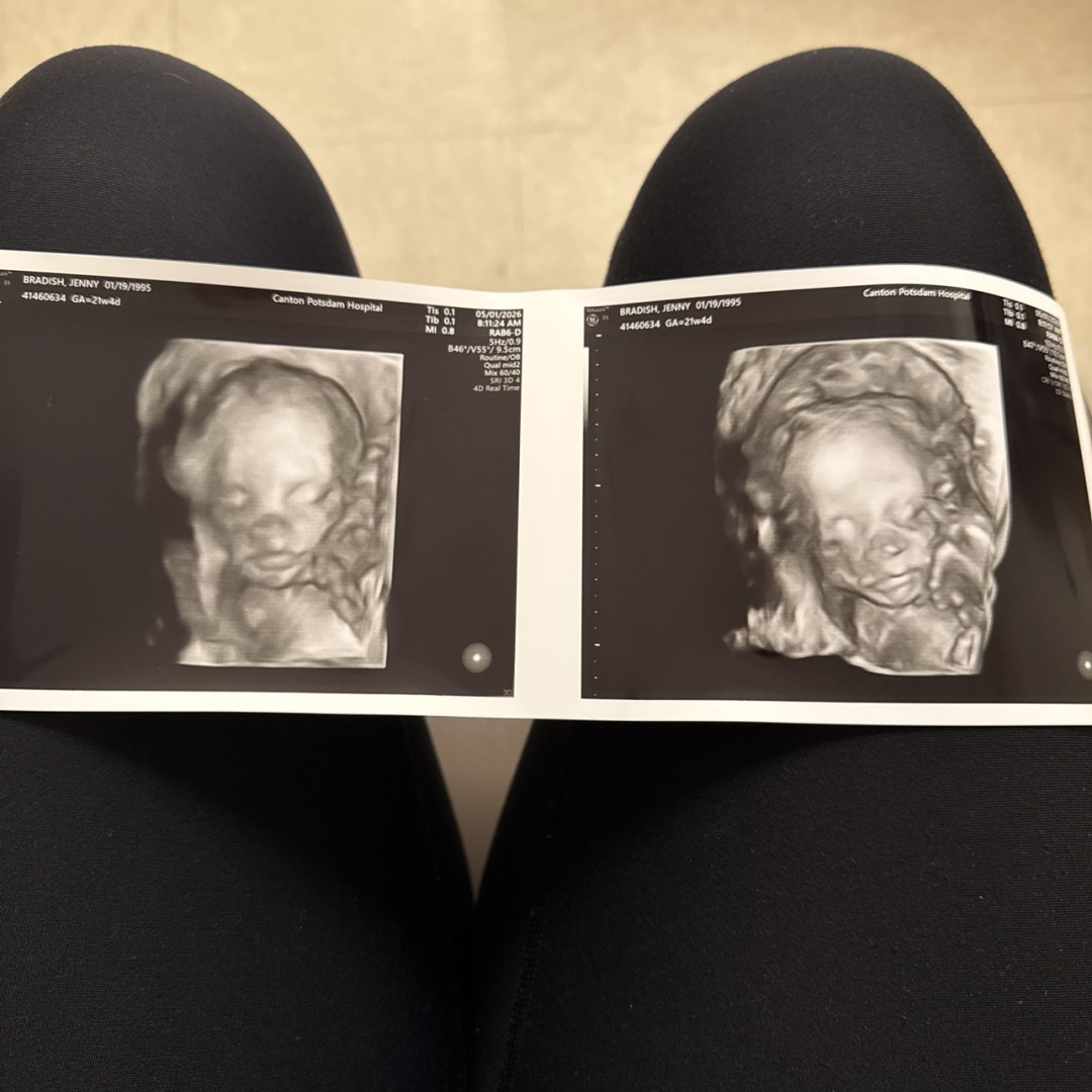 Photo shared by Jenny for their Babylist baby registry.