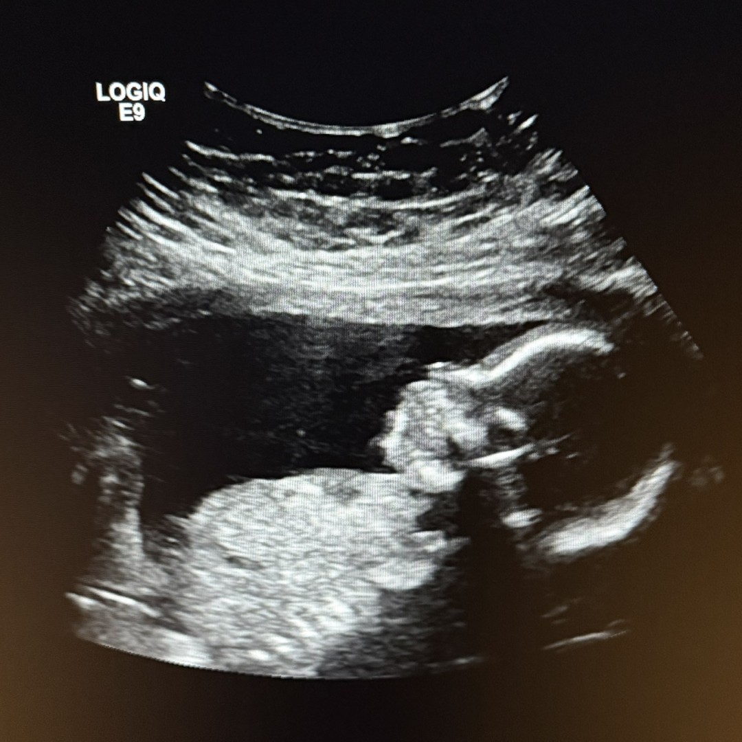 Photo shared by Kaitlin for their Babylist baby registry.