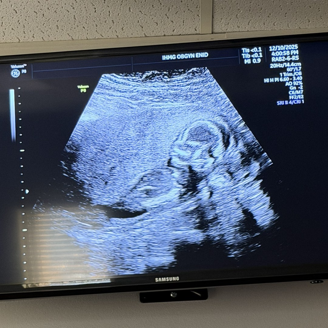 Photo shared by Emily for their Babylist baby registry.