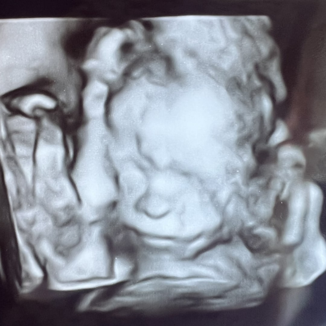 Photo shared by Macee for their Babylist baby registry.