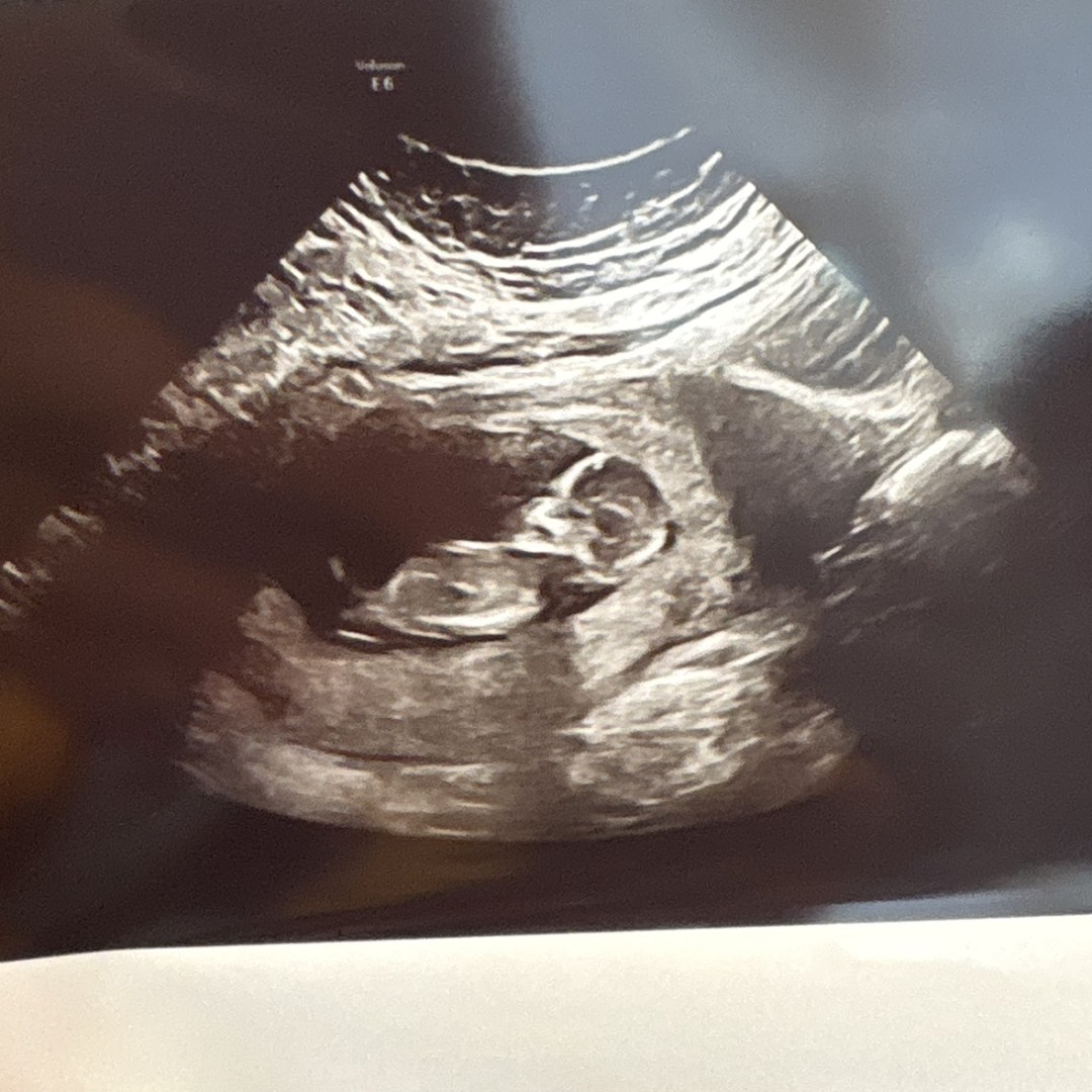 Photo shared by Breana for their Babylist baby registry.