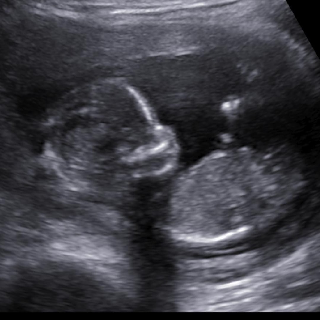 Photo shared by Brooke for their Babylist baby registry.