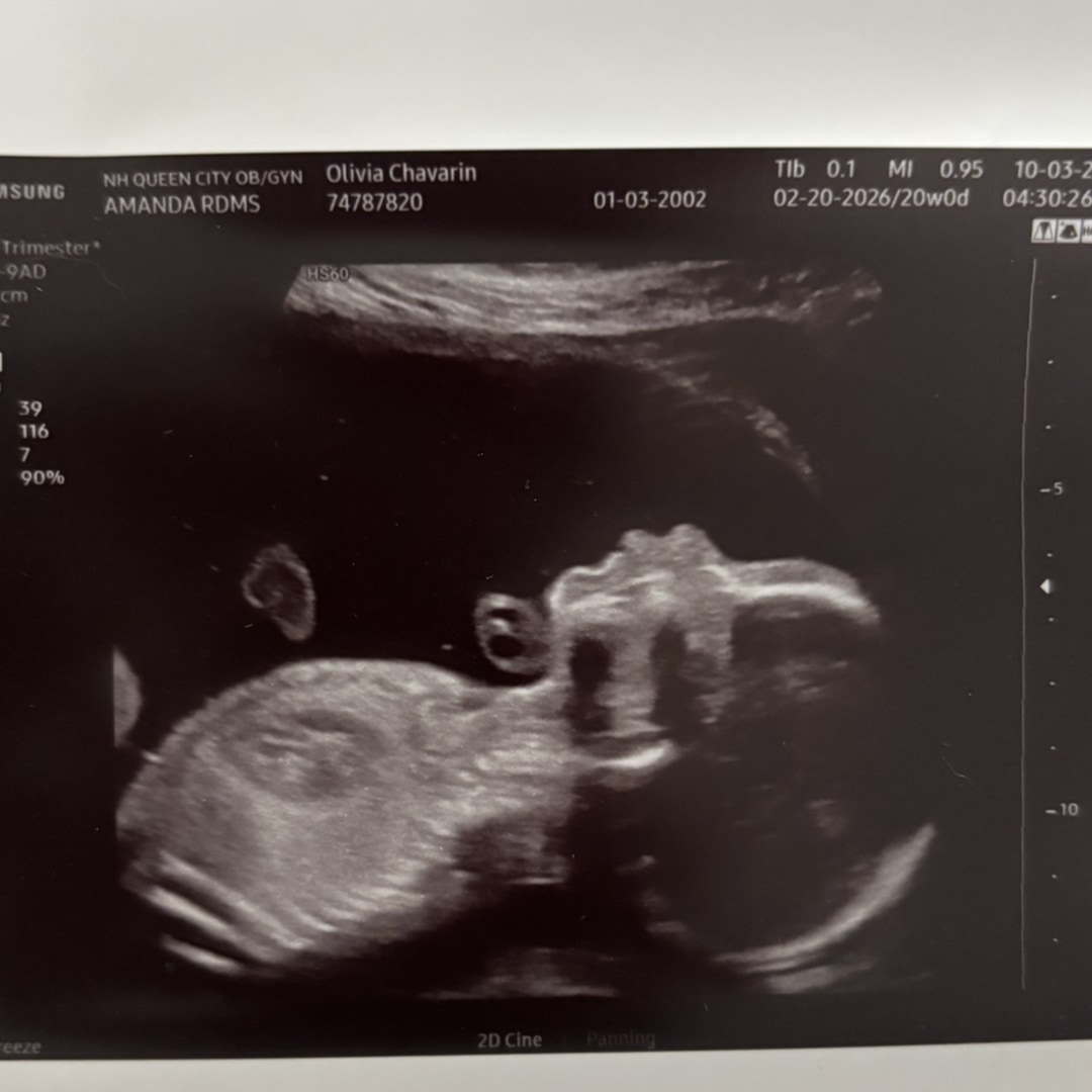 Photo shared by Olivia for their Babylist baby registry.