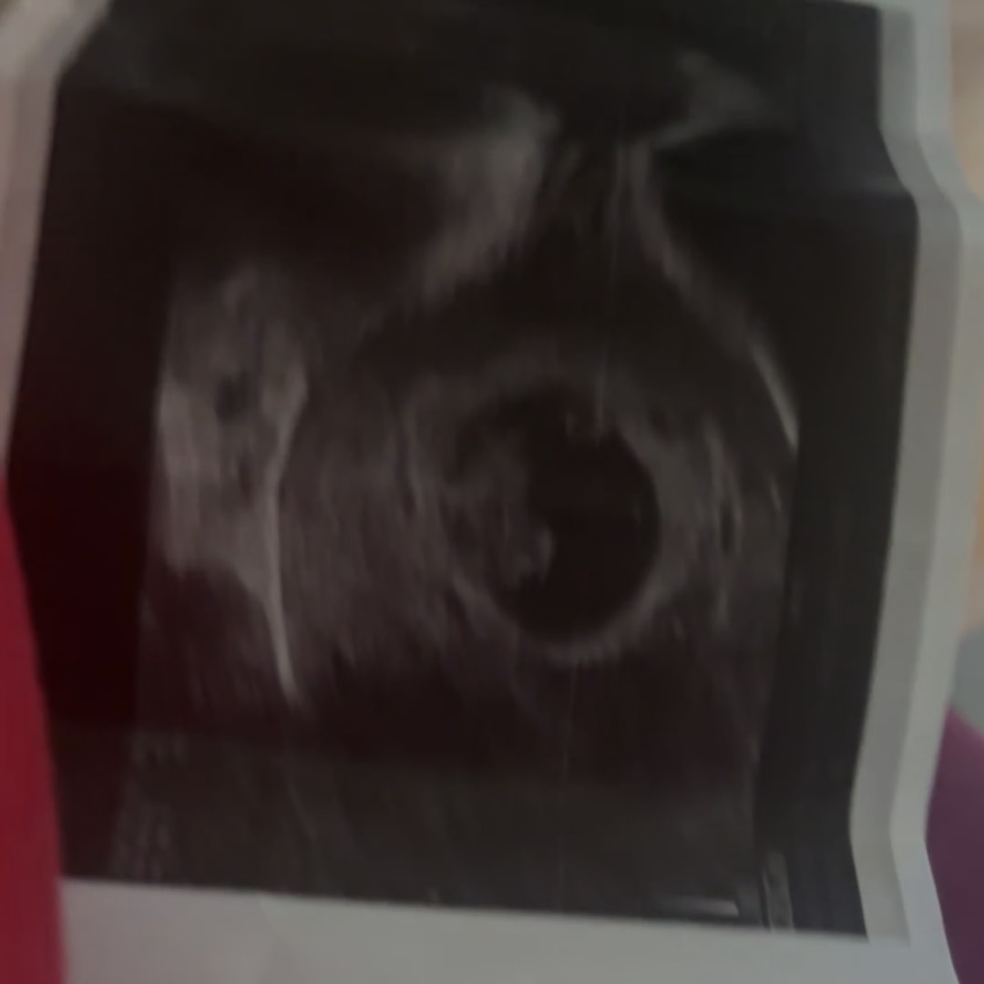 Photo shared by Renee for their Babylist baby registry.