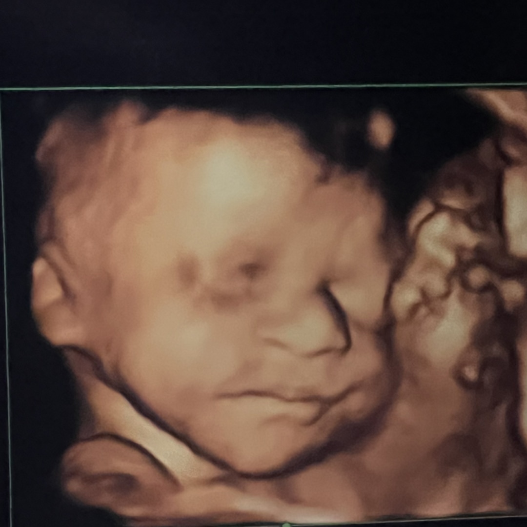 Photo shared by Jennifer for their Babylist baby registry.