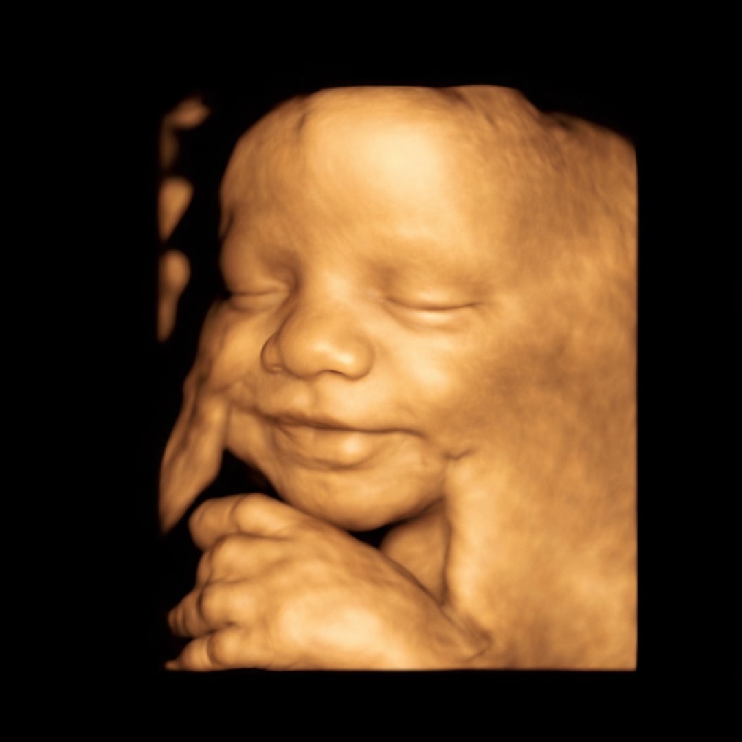 Photo shared by Kariegn for their Babylist baby registry.