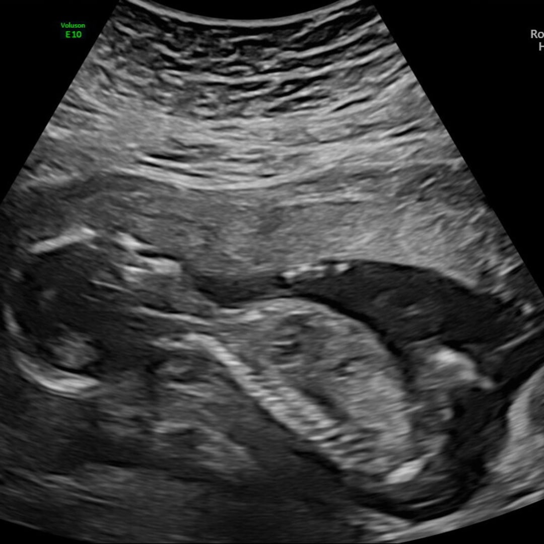 Photo shared by Aerial for their Babylist baby registry.