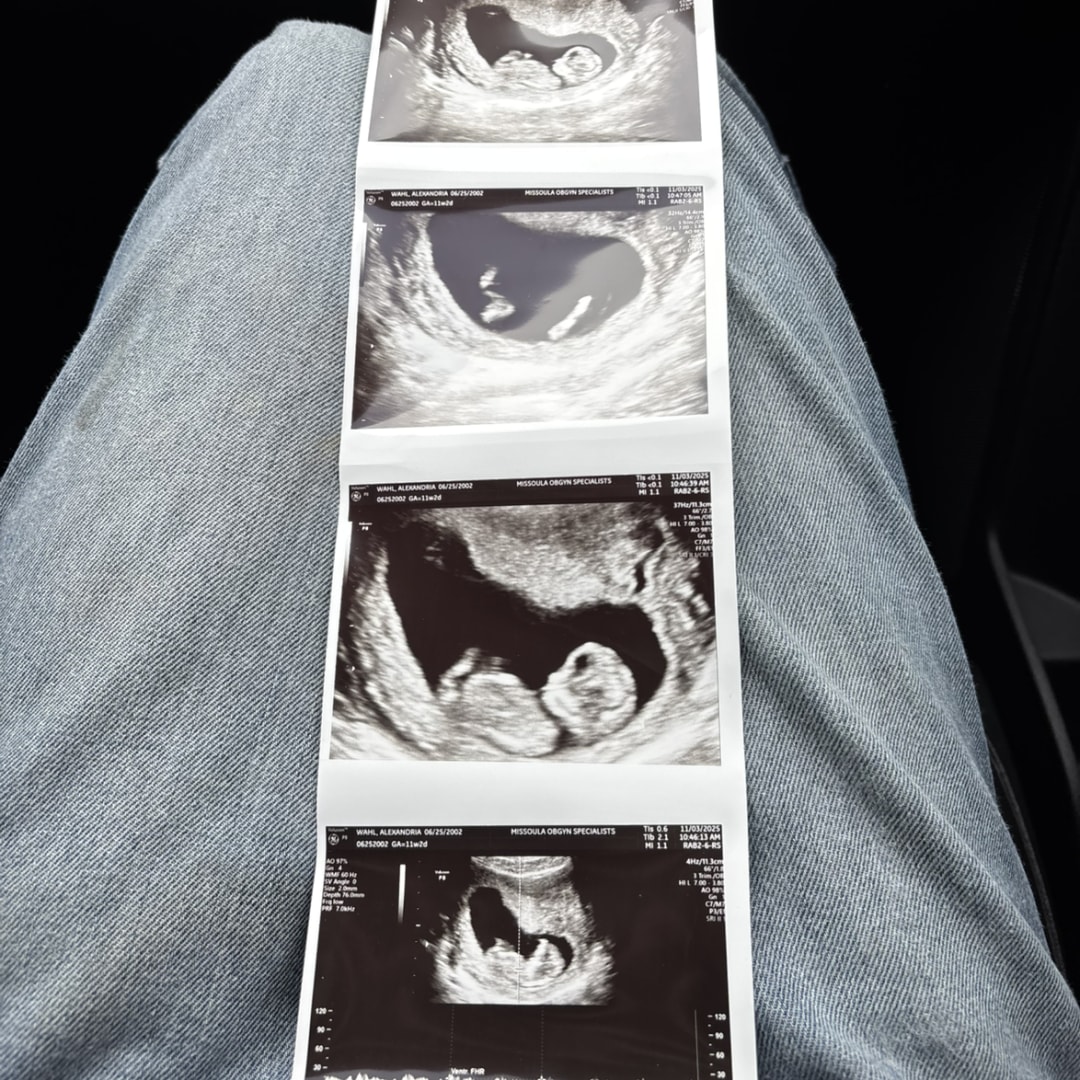 Photo shared by Alexandria for their Babylist baby registry.