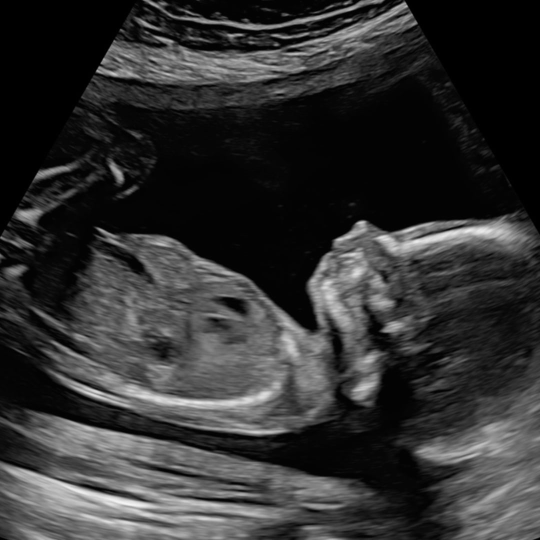 Photo shared by Rebecca for their Babylist baby registry.