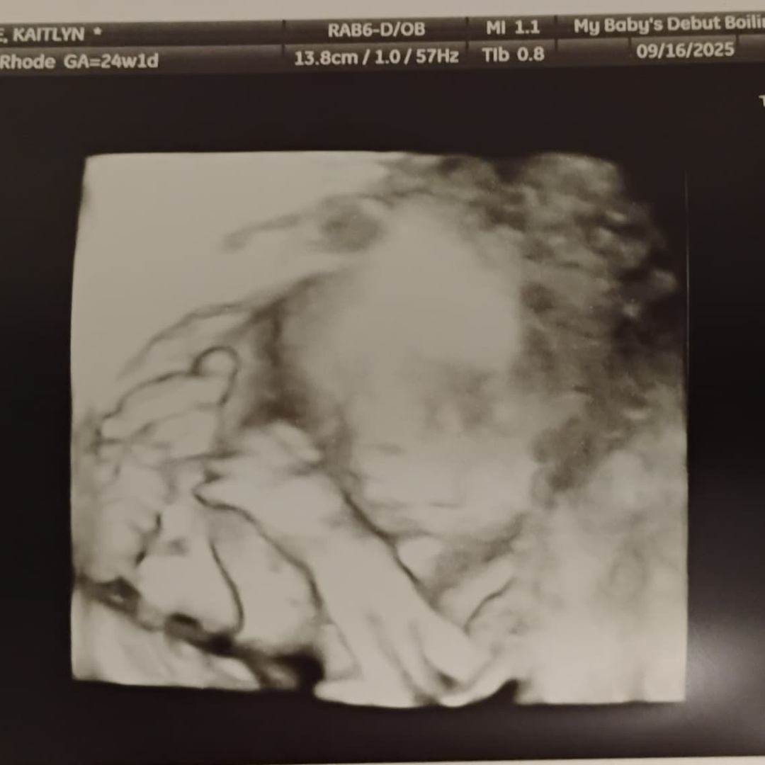 Photo shared by Kaitlyn for their Babylist baby registry.