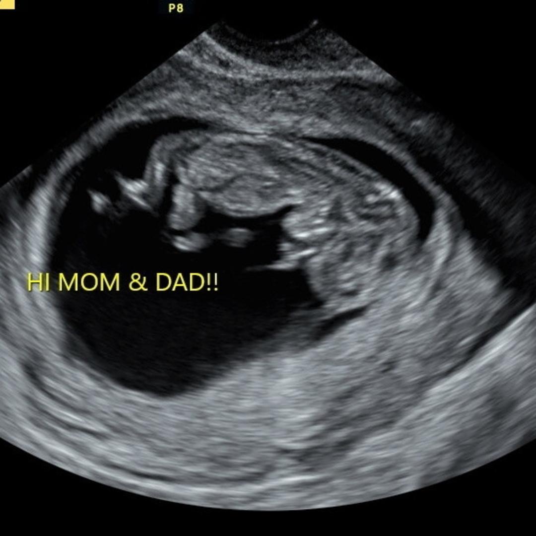 Photo shared by Sara for their Babylist baby registry.