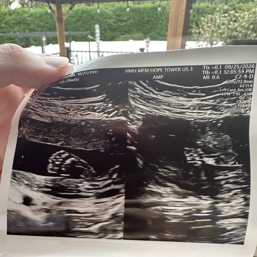 Photo shared by Alex for their Babylist baby registry.