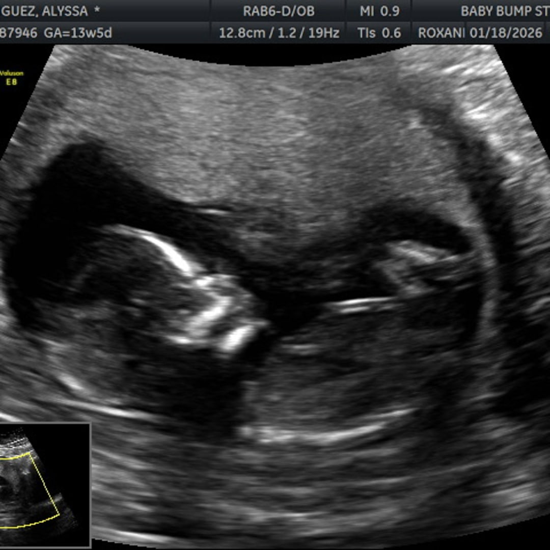 Photo shared by Alyssa for their Babylist baby registry.