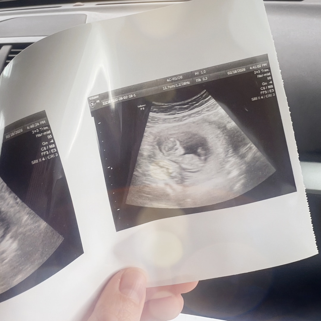 Photo shared by Hannah for their Babylist baby registry.