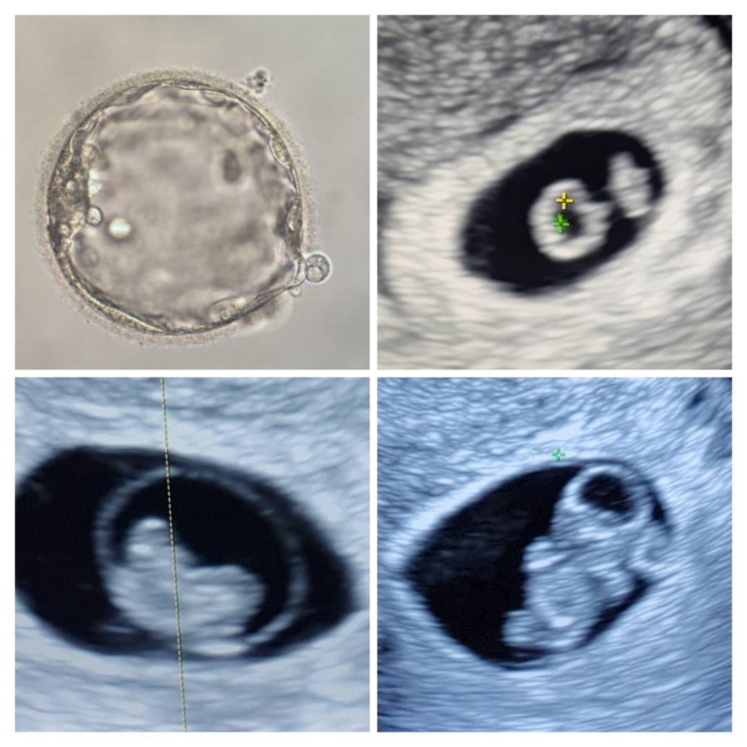 Photo shared by Jennifer for their Babylist baby registry.