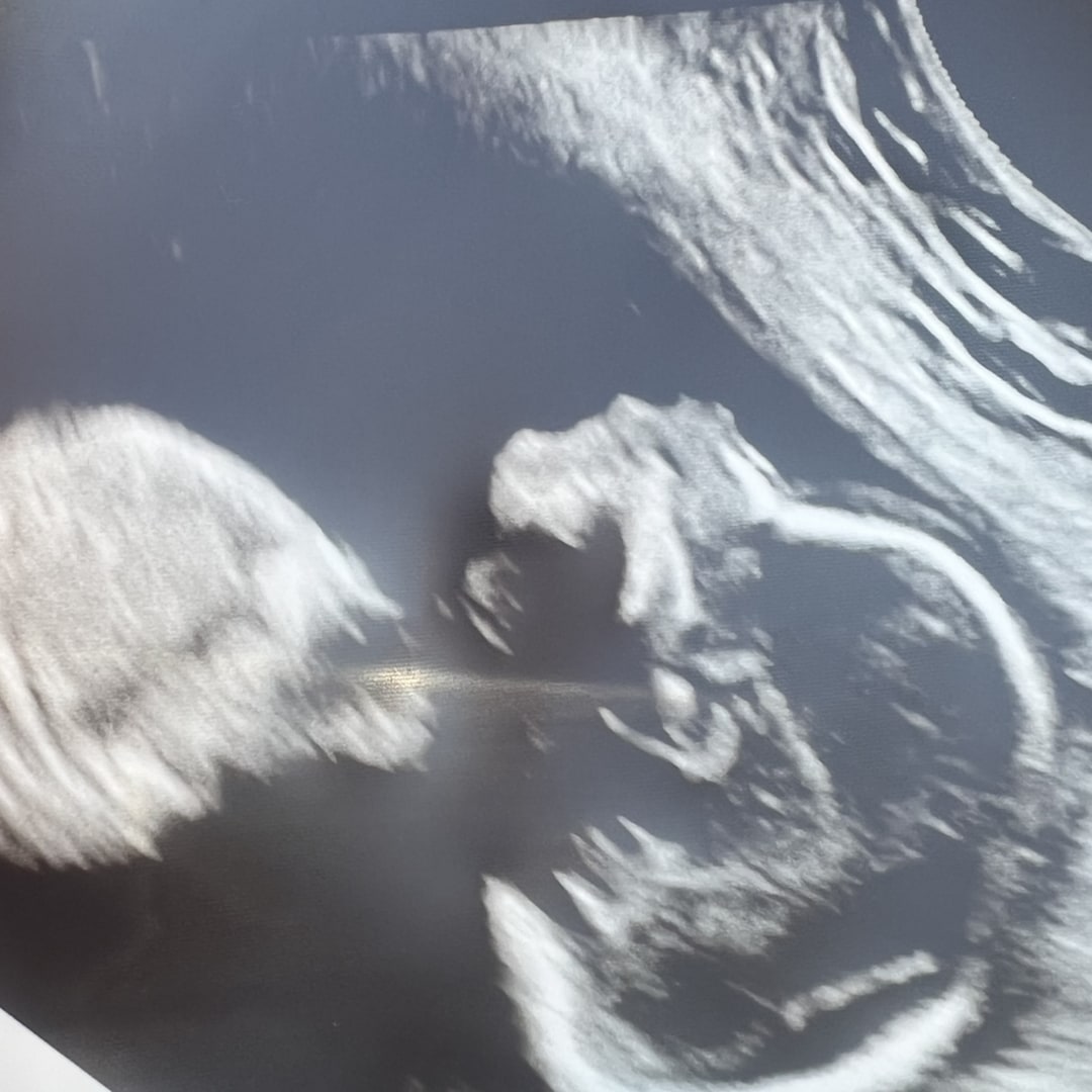Photo shared by Kendralynne for their Babylist baby registry.