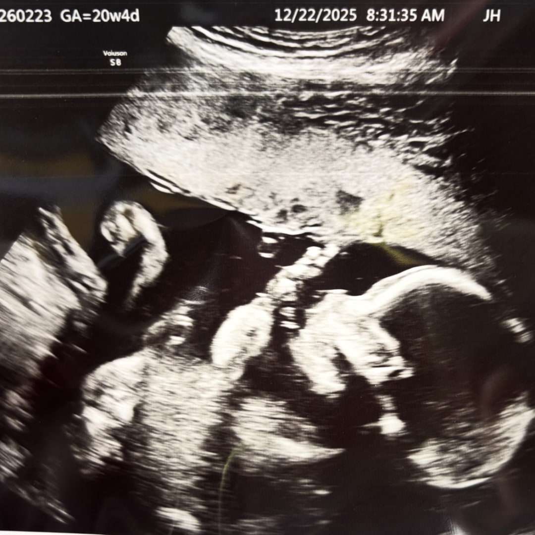 Photo shared by Kelcee for their Babylist baby registry.