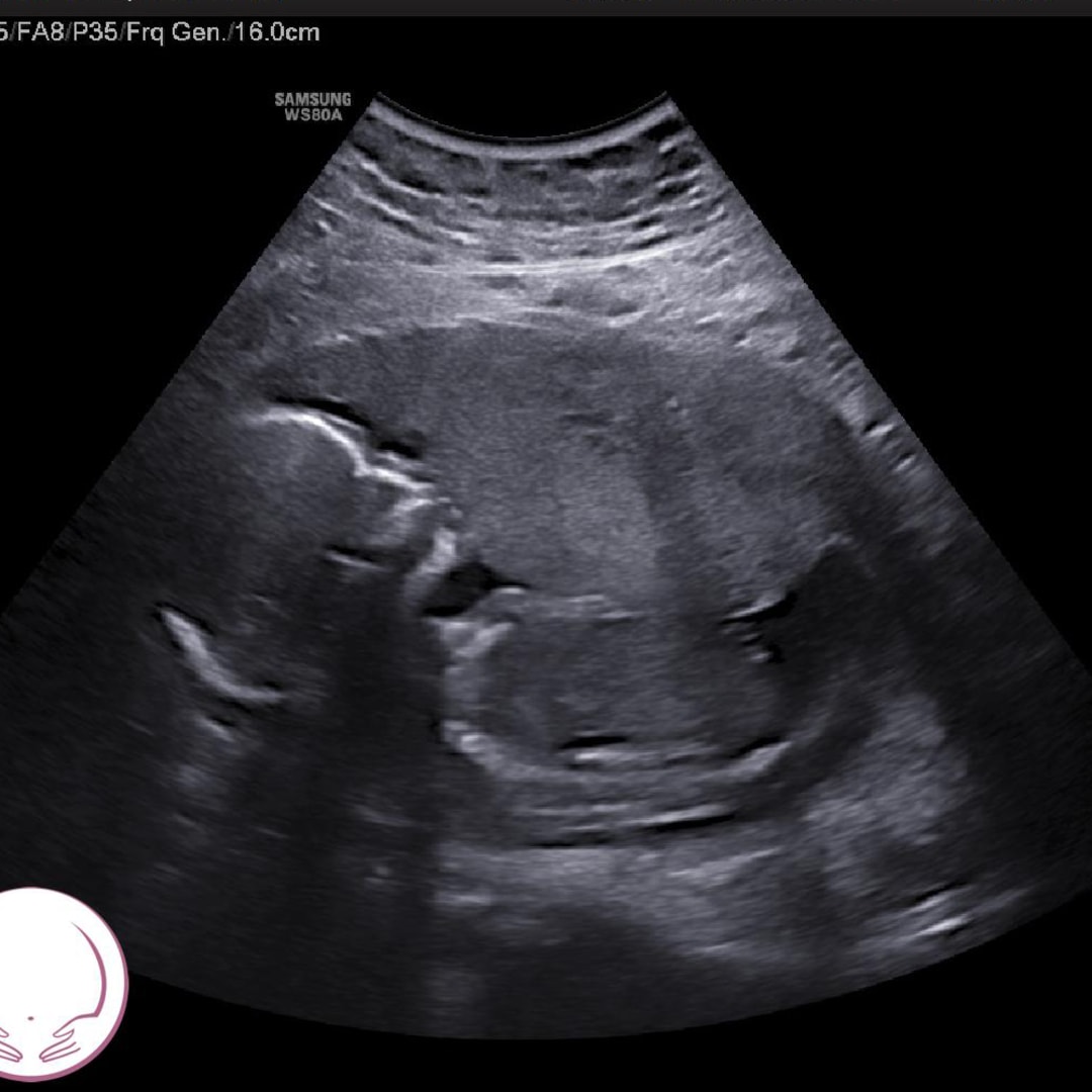 Photo shared by Brittani for their Babylist baby registry.