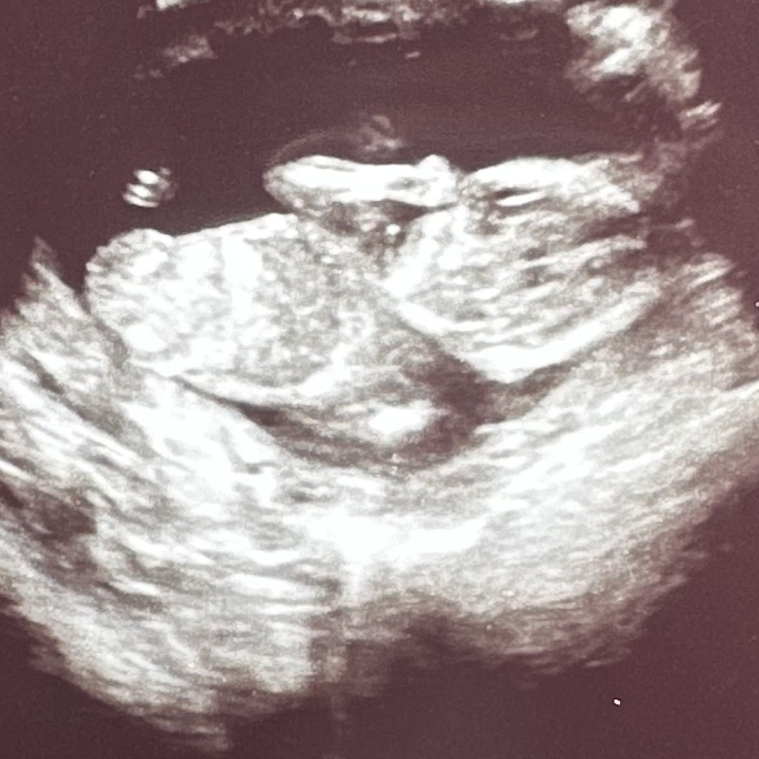 Photo shared by Summer for their Babylist baby registry.