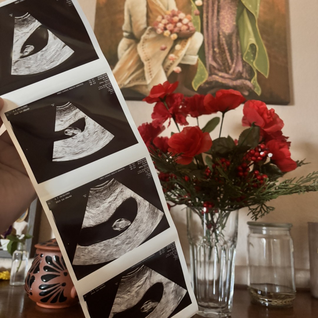Photo shared by Yesii for their Babylist baby registry.