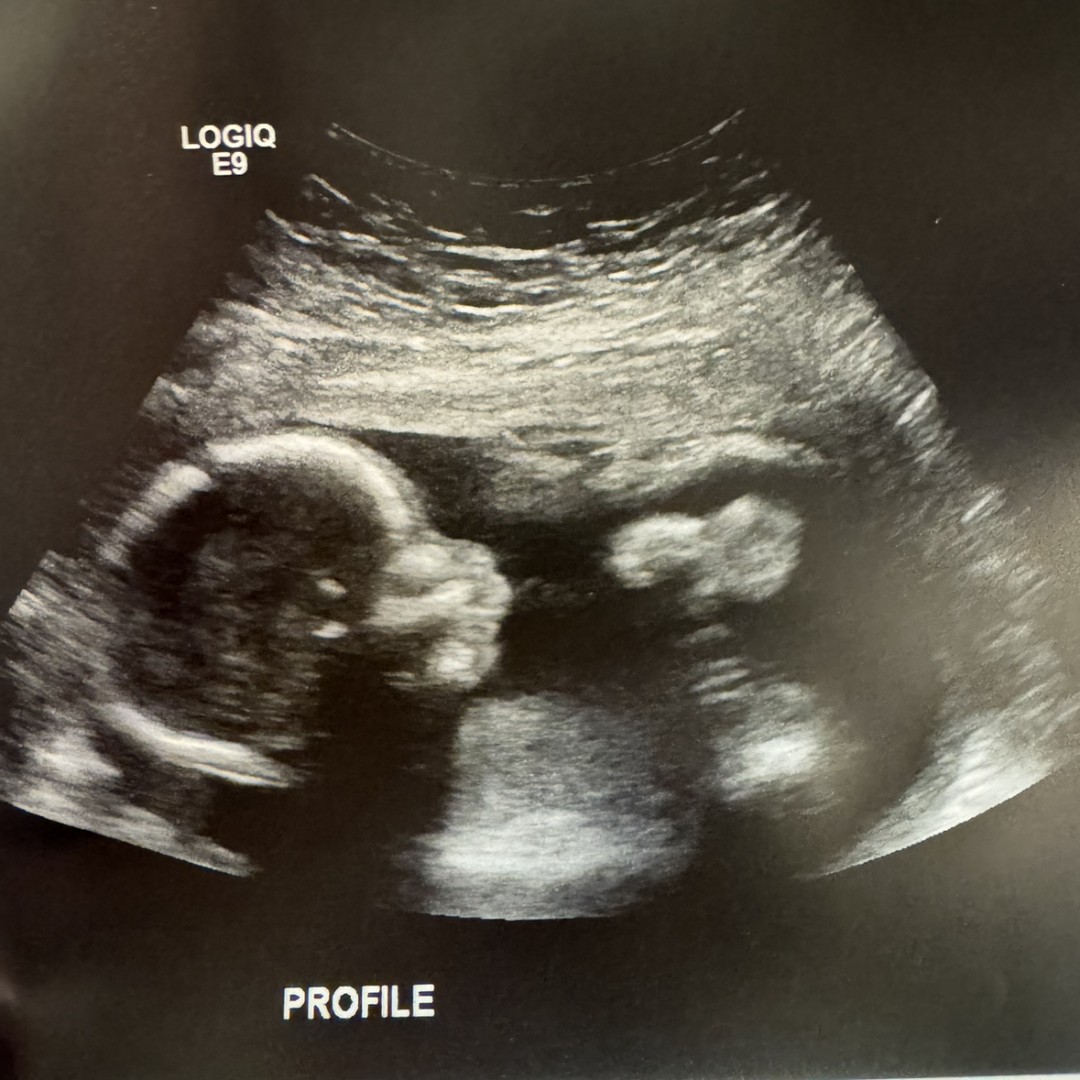 Photo shared by Giana for their Babylist baby registry.