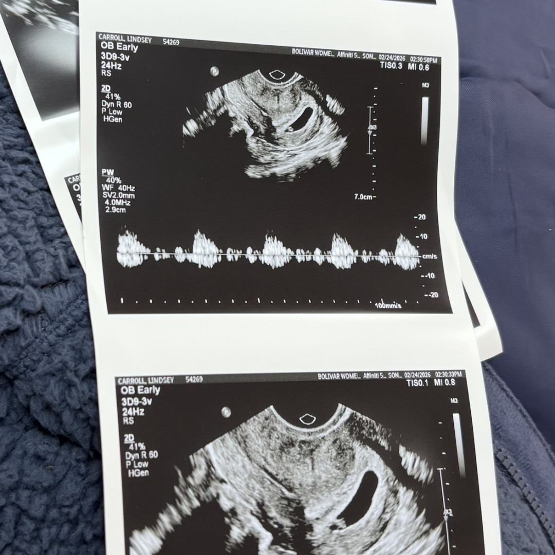 Photo shared by Lindsey for their Babylist baby registry.