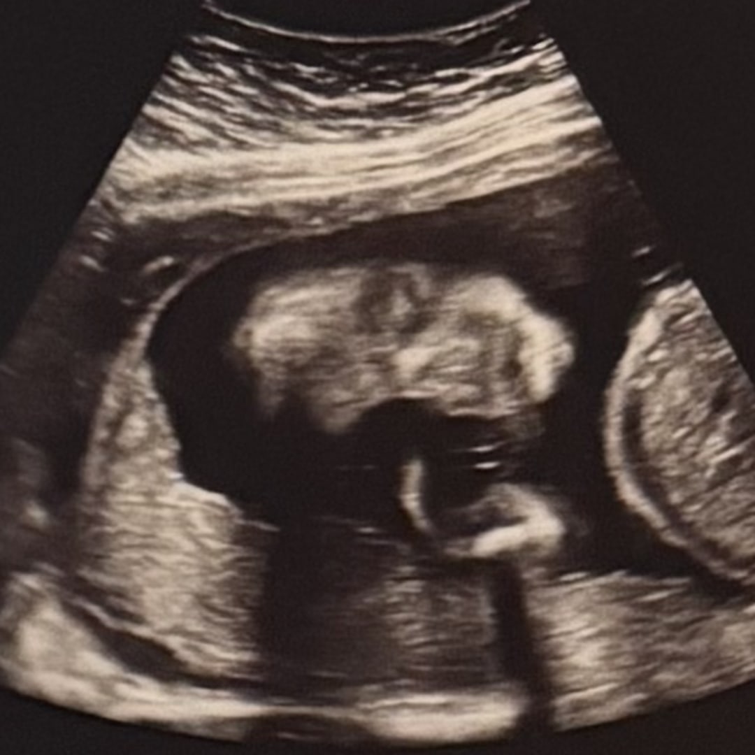 Photo shared by Chelsea for their Babylist baby registry.