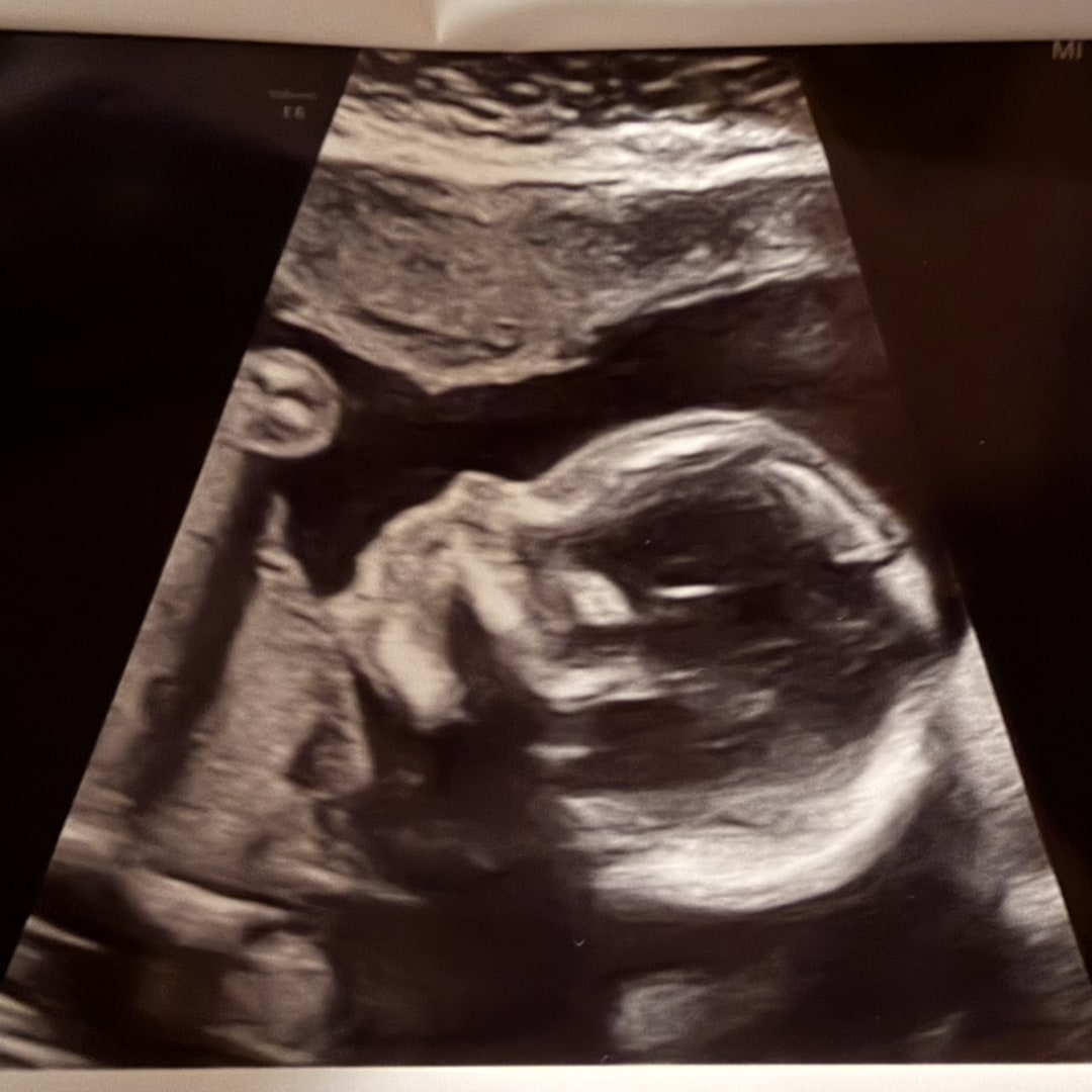 Photo shared by Haley for their Babylist baby registry.