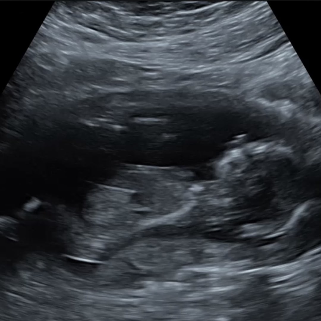 Photo shared by Addisen for their Babylist baby registry.