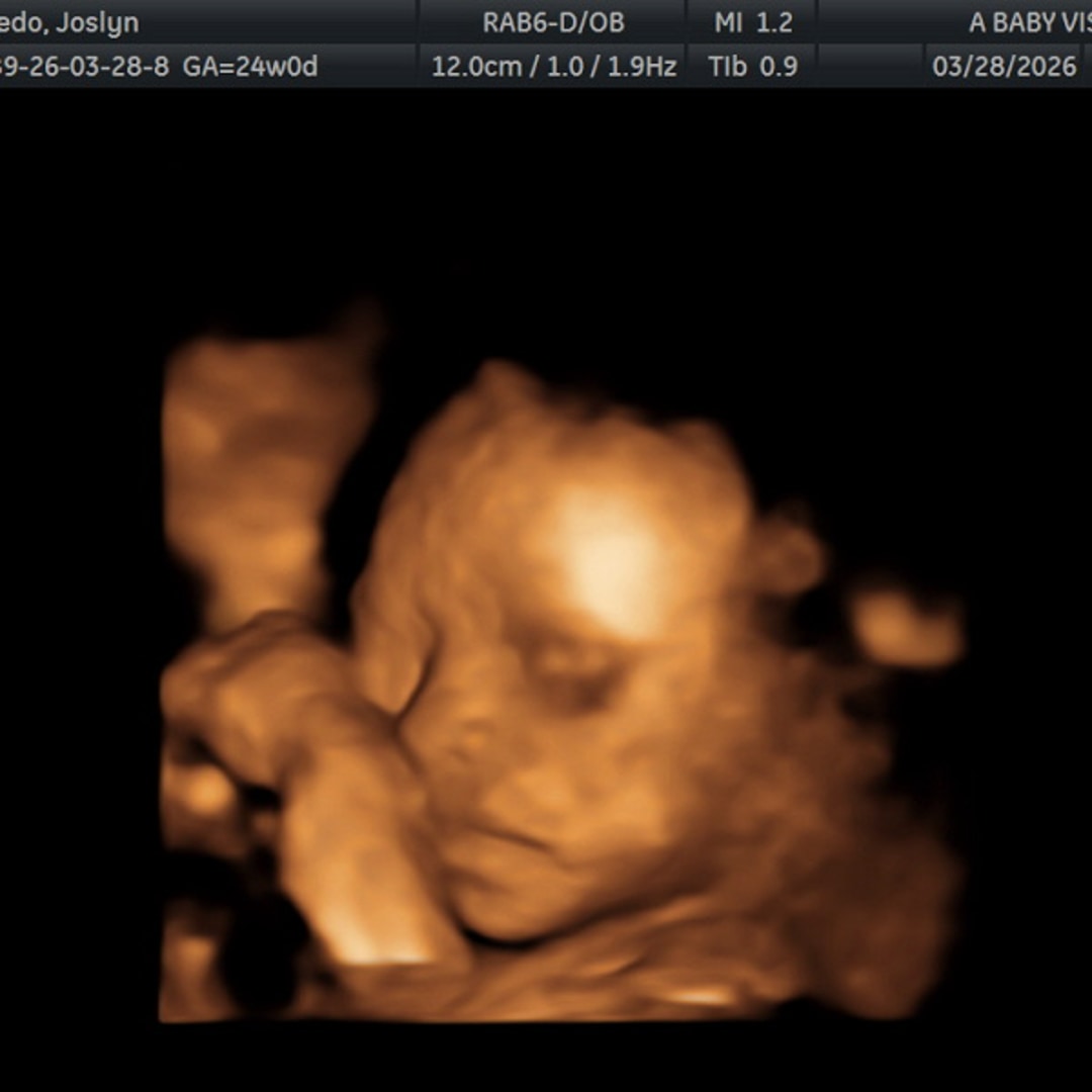 Photo shared by Joslyn for their Babylist baby registry.