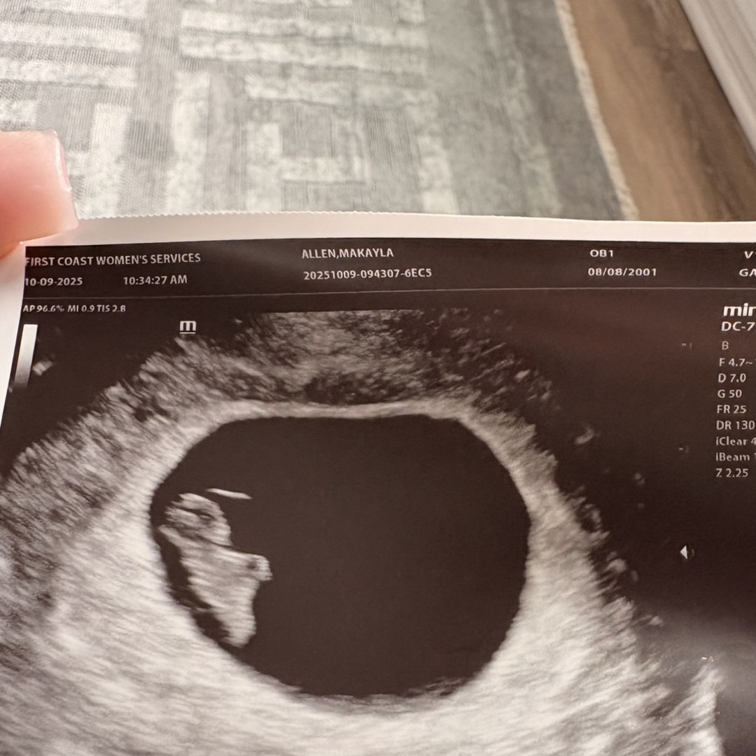 Photo shared by Makayla for their Babylist baby registry.