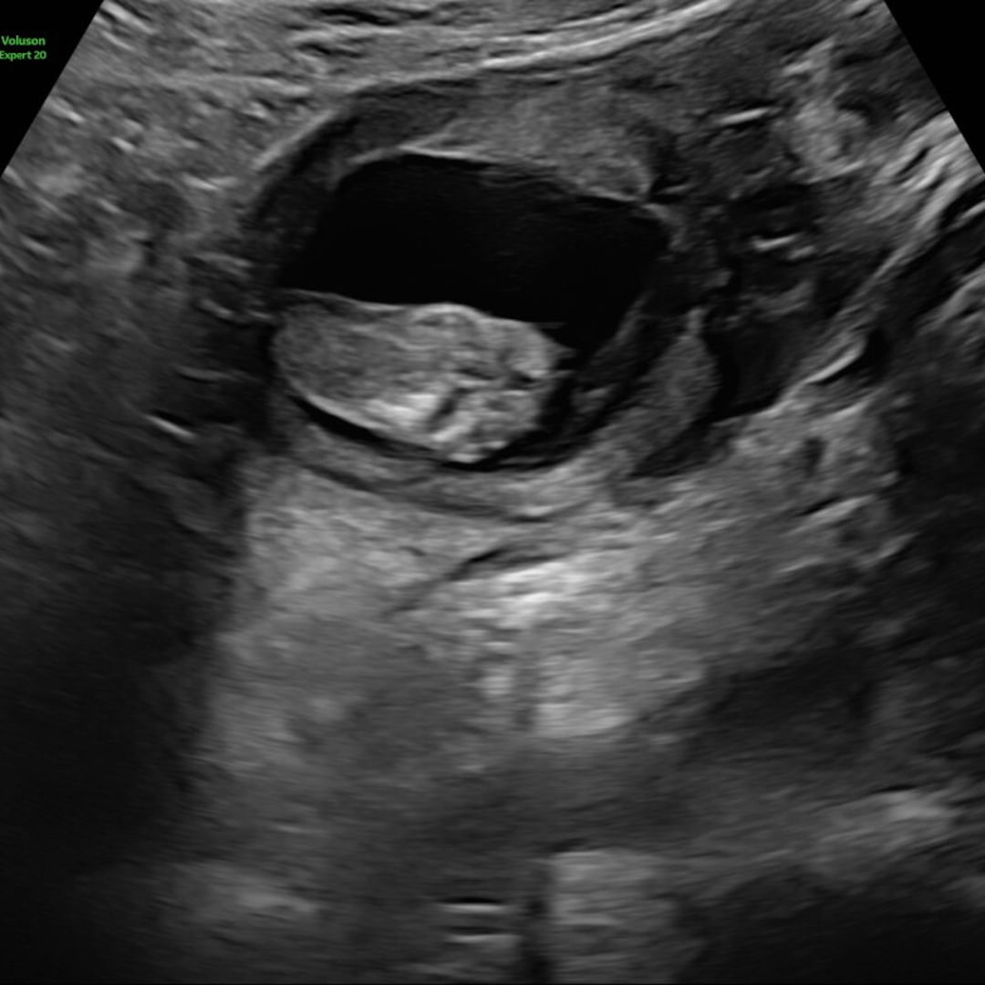 Photo shared by Kristine for their Babylist baby registry.