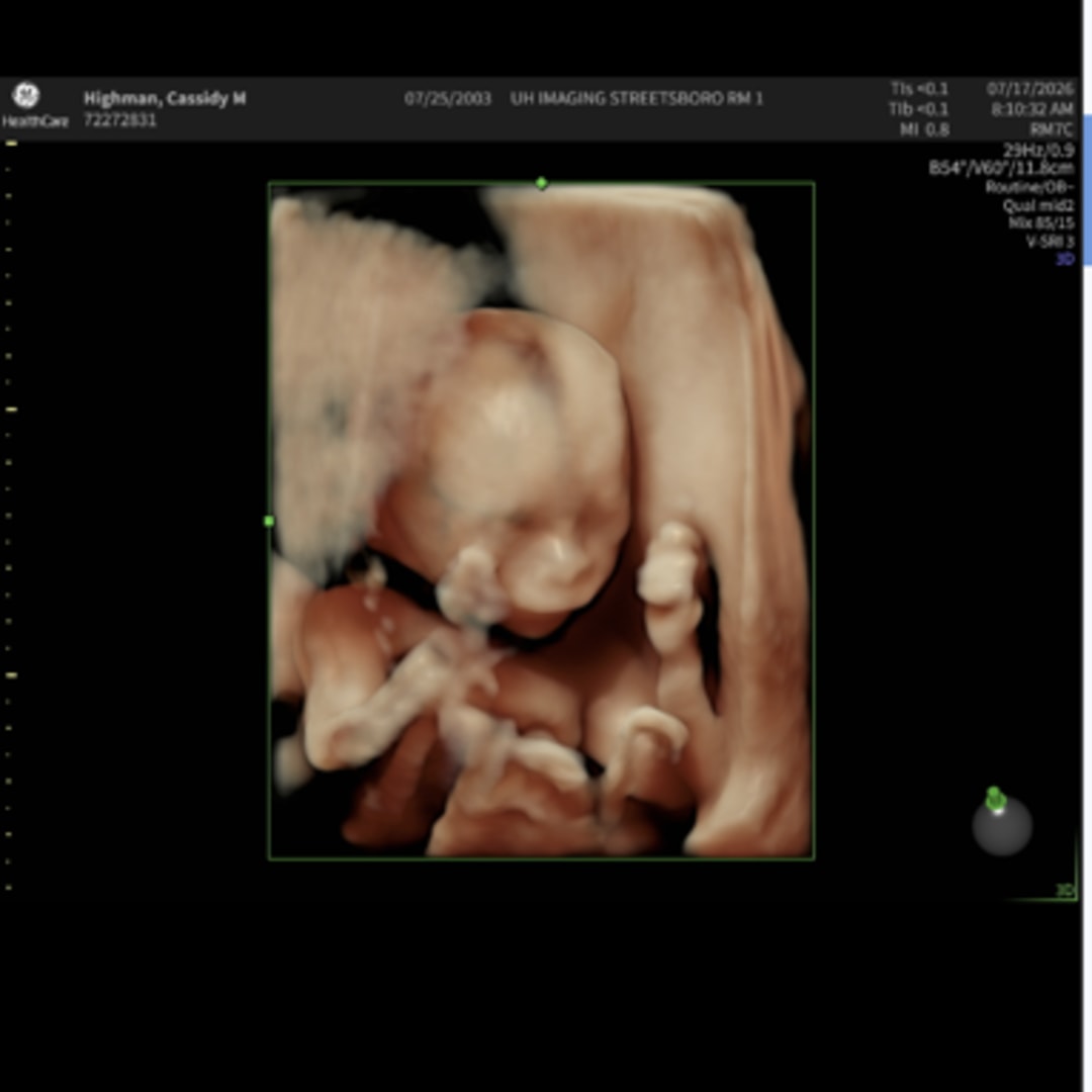 Photo shared by Cassidy for their Babylist baby registry.
