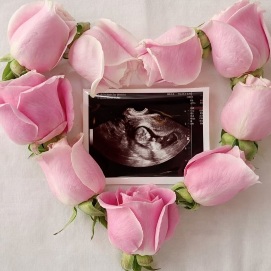 Photo shared by Autumn for their Babylist baby registry.