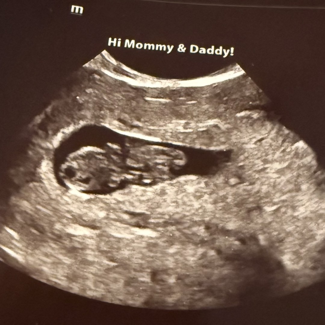 Photo shared by Jenna for their Babylist baby registry.