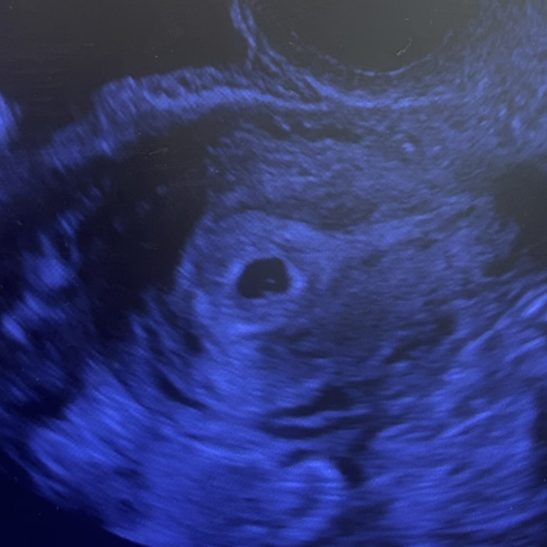 Photo shared by Alexis for their Babylist baby registry.