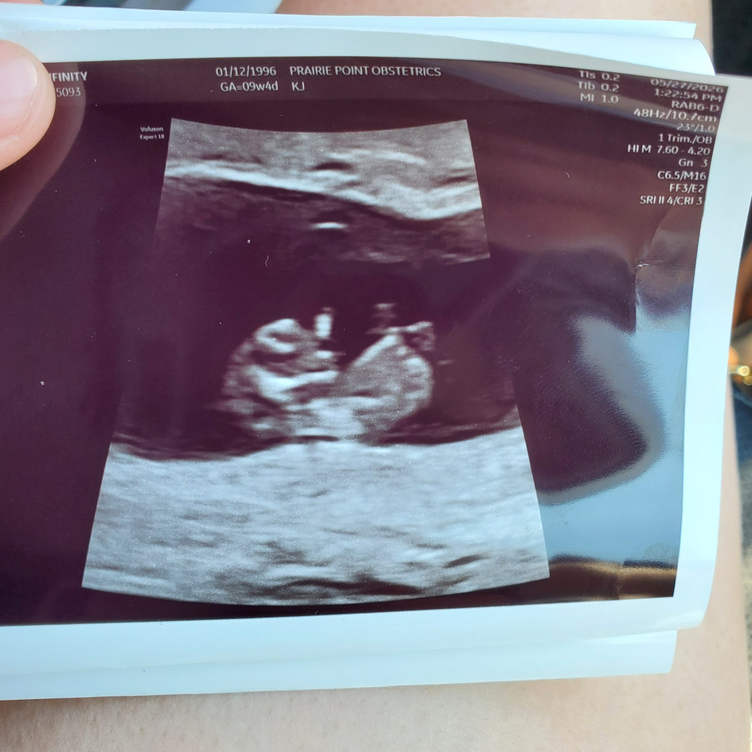 Photo shared by Infinity for their Babylist baby registry.