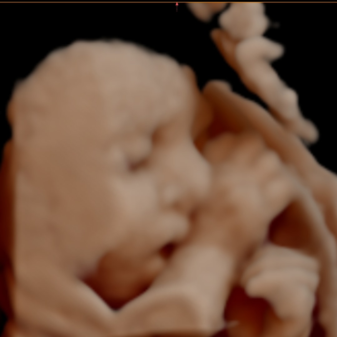 Photo shared by Brittany for their Babylist baby registry.