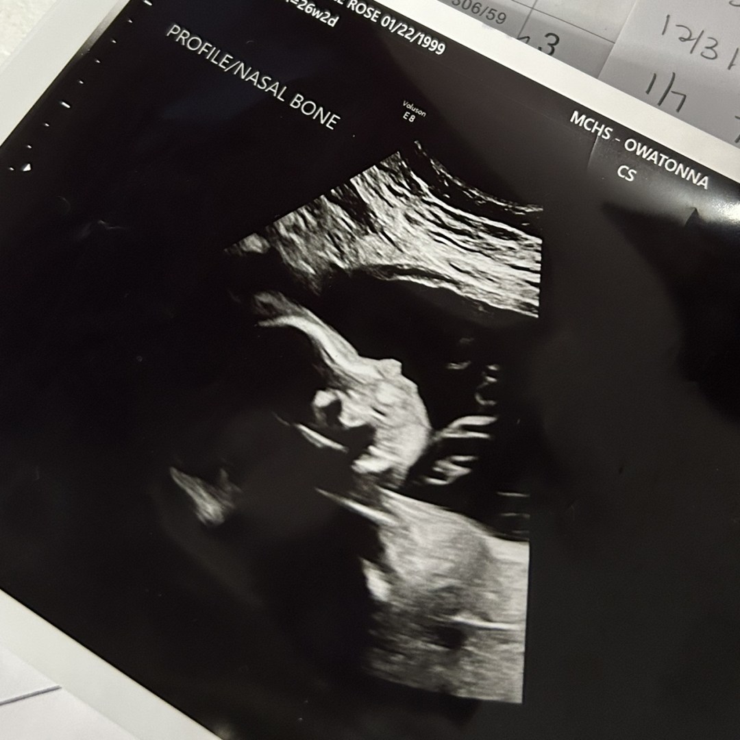 Photo shared by Kylee for their Babylist baby registry.