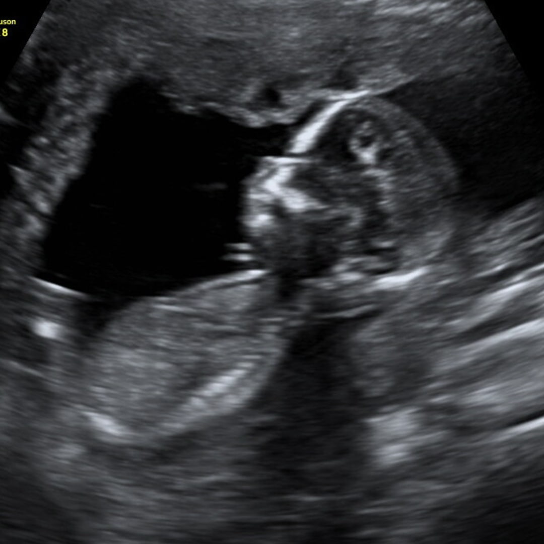 Photo shared by Destiny for their Babylist baby registry.