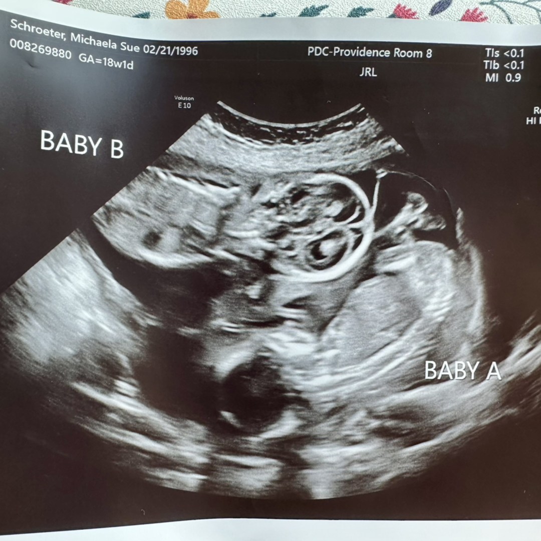 Photo shared by Michaela for their Babylist baby registry.